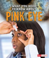 What_You_Need_to_Know_about_Pink_Eye